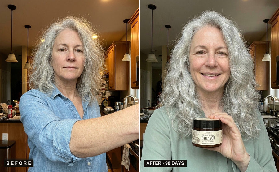 Before and after