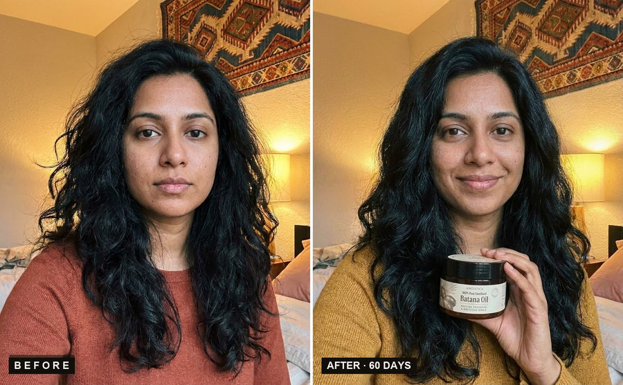 Before and after